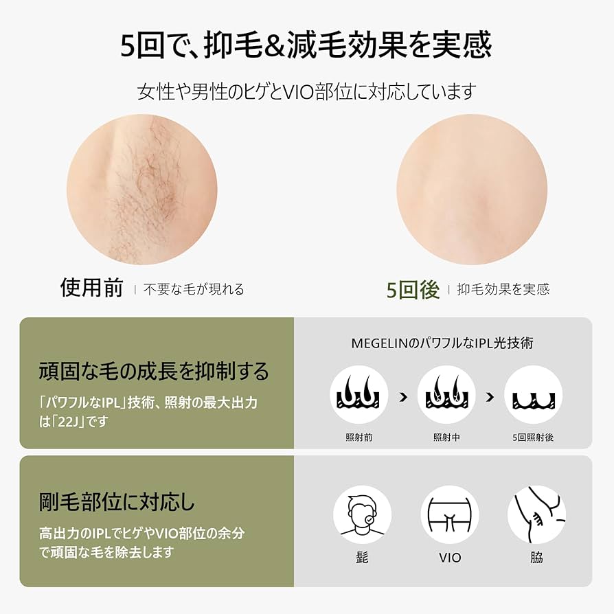 Amazon | MEGELIN M1 脱毛器 メンズ だつもうき脱毛器 メンズ
